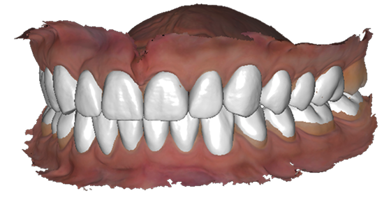 teeth.png